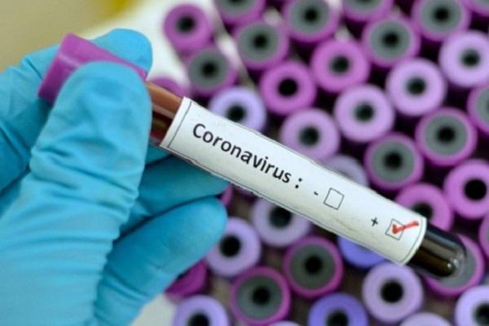 [COVID-19] Người thứ 32 nhiễm virus corona tại Việt Nam có tiếp xúc với bệnh nhân thứ 17