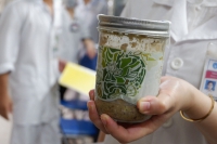 Ngộ độc pate Minh Chay: Botulinum nguy hiểm thế nào và phòng tránh ra sao?