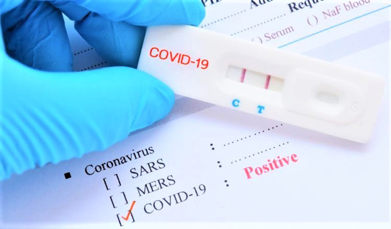 Bộ Y tế đã cấp phép cho 97 test xét nghiệm, trong đó có 35 test xét nghiệm PCR và 39 test xét nghiệm kháng nguyên để đảm bảo sự cạnh tranh lành mạnh.