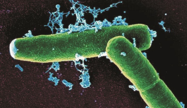 Bacillus anthracis, mầm bệnh gây ra bệnh than. Ảnh: CDC Trung Quốc.