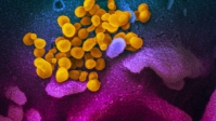 Tình báo Mỹ hé lộ kết quả điều tra nguồn gốc virus SARS-CoV-2