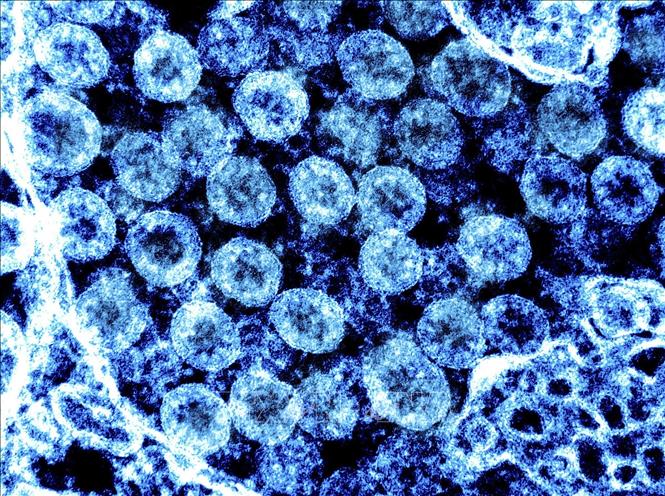 Hình ảnh từ kính hiển vi do Viện nghiên cứu bệnh truyền nhiễm và dị ứng quốc gia Mỹ cung cấp cho thấy các phần tử virus SARS-CoV-2 trong mẫu bệnh phẩm của bệnh nhân mắc COVID-19. Ảnh: AFP/TTXVN