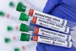 Cảnh báo nguy cơ bệnh đậu mùa khỉ lan rộng khắp Đông Nam Á