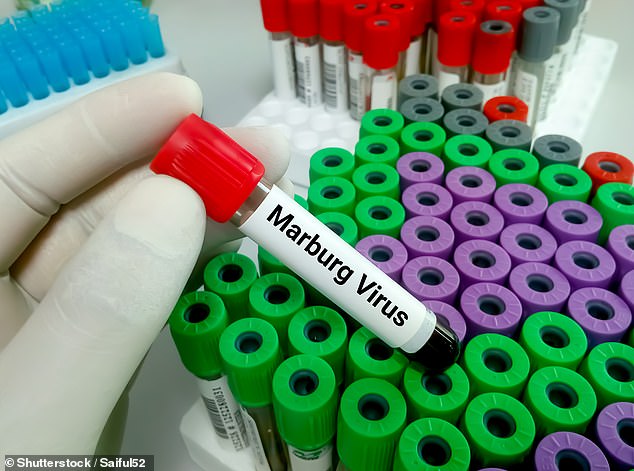 2 ca tử vong ở châu Phi được xác định là do nhiễm virus Marburg
