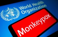 WHO tuyên bố tình trạng khẩn cấp y tế toàn cầu với bệnh đậu mùa khỉ