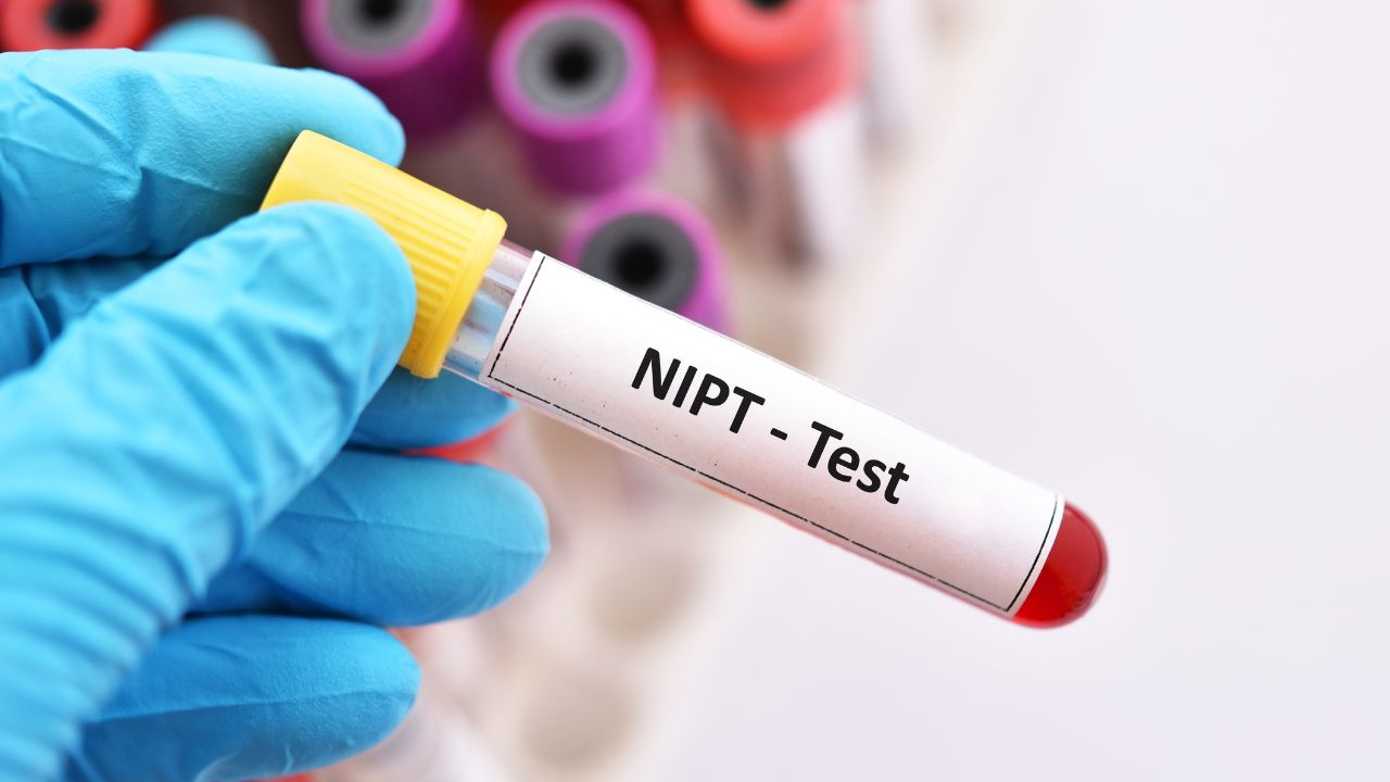 NIPT có thể cho kết quả chính xác lên đến 99%